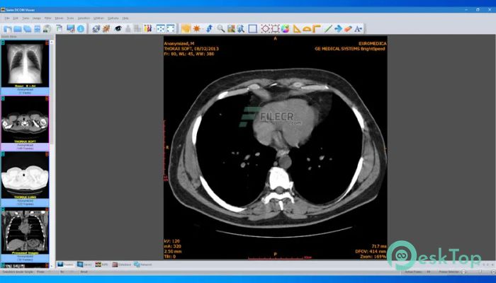 Download Sante DICOM Viewer Pro 14.4.1 Free Download for Windows