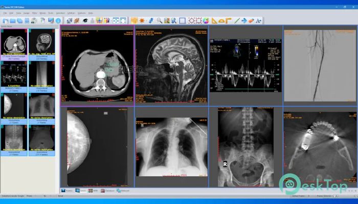 Sante DICOM Editor 10.4.1 Free Download for Windows