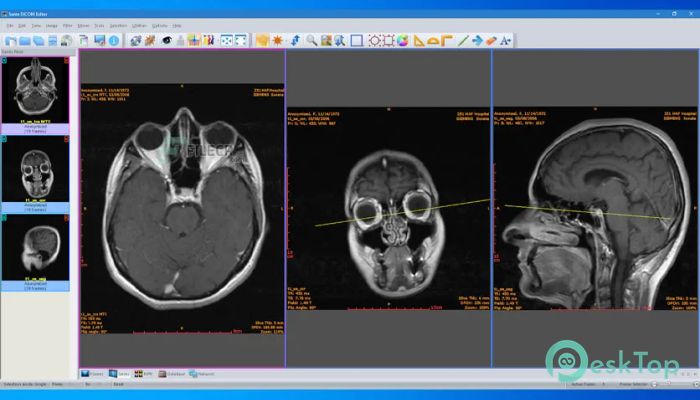Sante DICOM Editor 10.4.1 Free Download for Windows